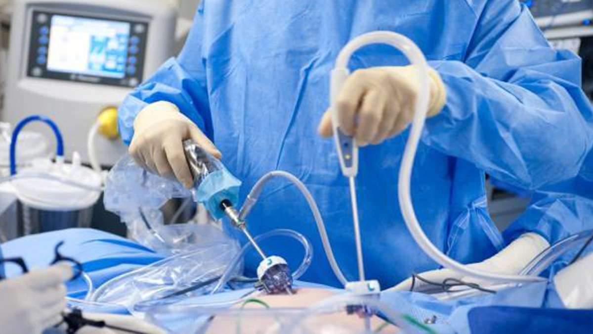 All About Laparoscopic Cancer Surgery